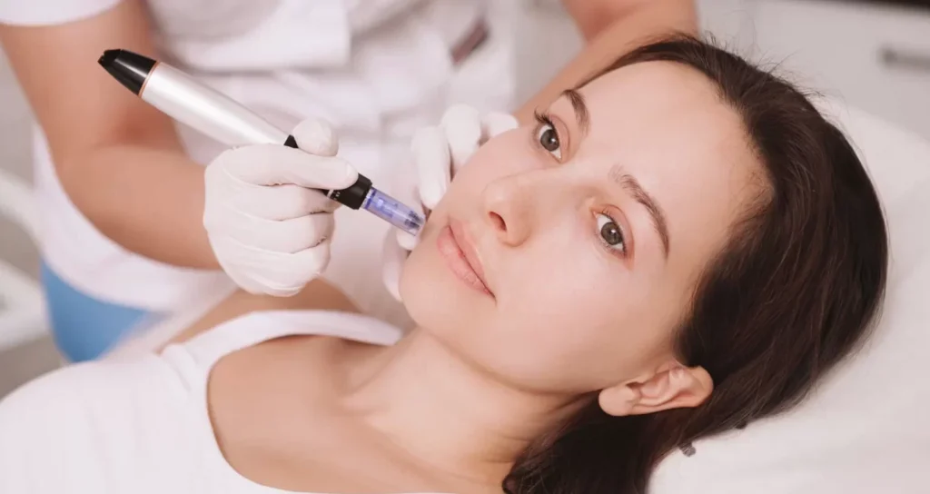 Micro-needling with or without PRP treatments