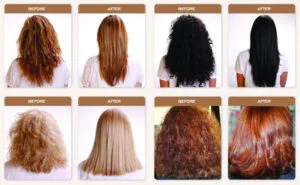 Types of Hair Suitable for Botox Treatments,The Way We Are Service For Hair Restoration Transforming