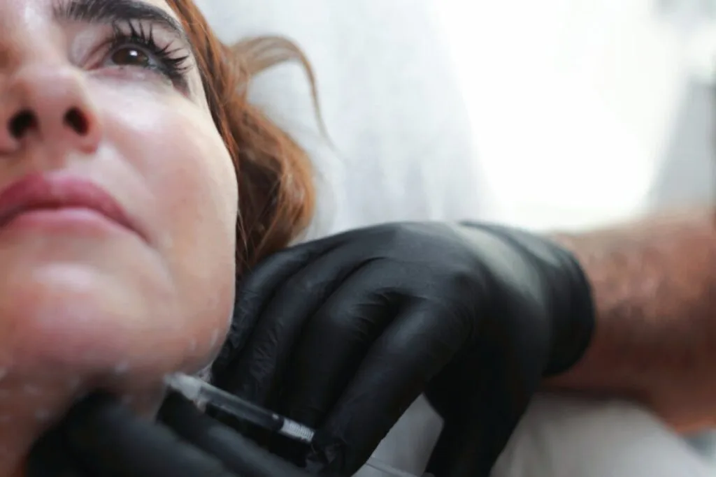 Cellenis DermaFiller, How Long Do Dermal Fillers Last?jawline filler swelling stages, Long Do Jawline Fillers Last