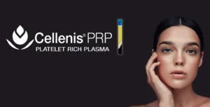 Cellenis DermaFiller,How long do prp injections last, cellenis dermal filler cost, Cellenis Derma PRP in Miami