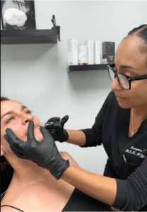 Lip Filler, Lip Flip miramar, Can microneedling enhance the appearance of my lips?, Lip filler in Miami