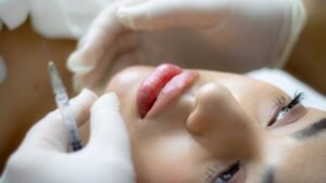 Jawline Fillers, how does Lip flip work, Lip Fillers in Florida,