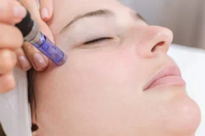 Mesotherapy, Top 7 FAQs About Mesotherapy