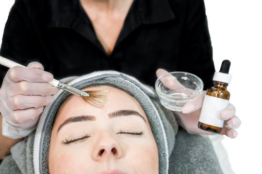 Chemical Peel Treatment in Hallandale