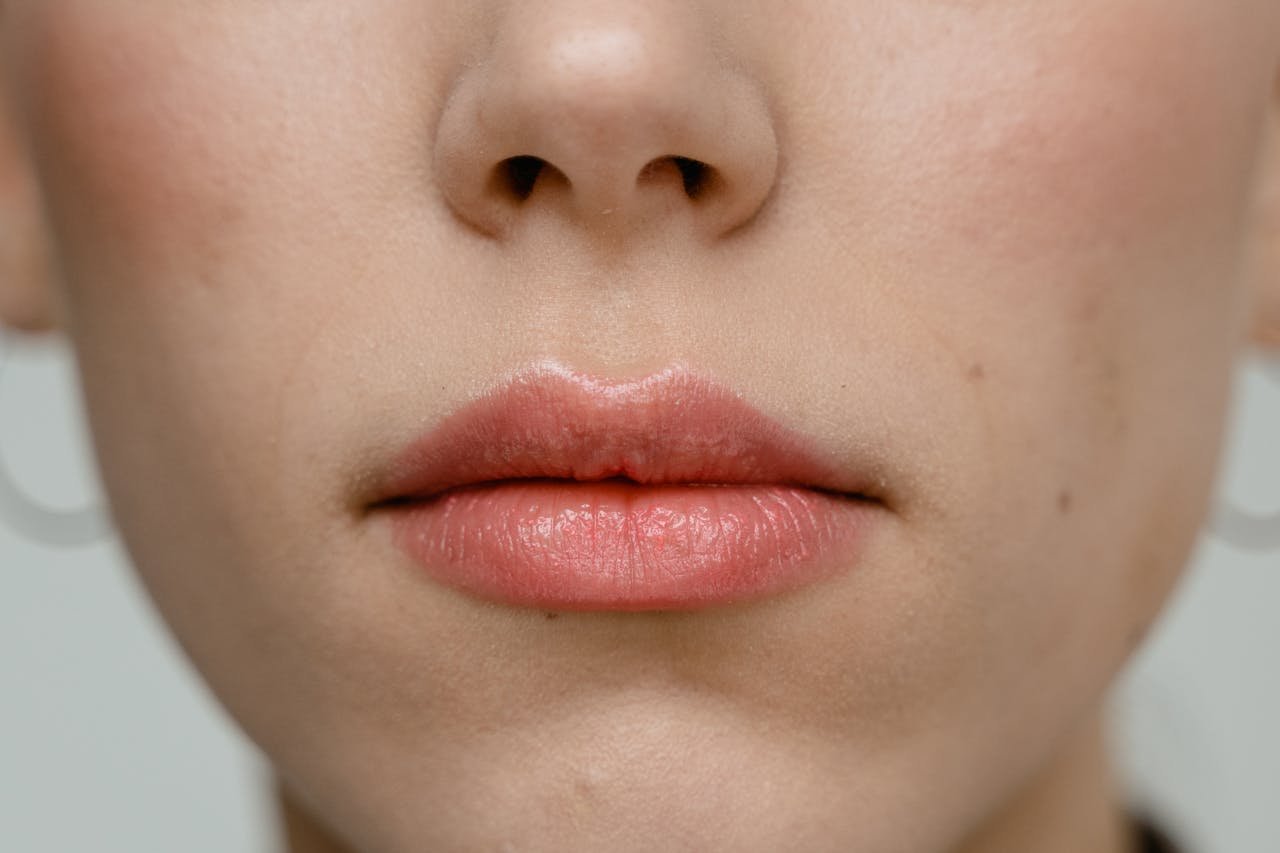 Botox, Botox for Chin Dimple, Lip Flip Results