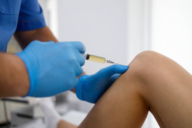 Knee PRP Injections in Florida, Best Sclerotherapy in Miami