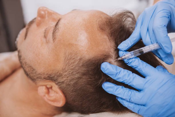 PRF Injection