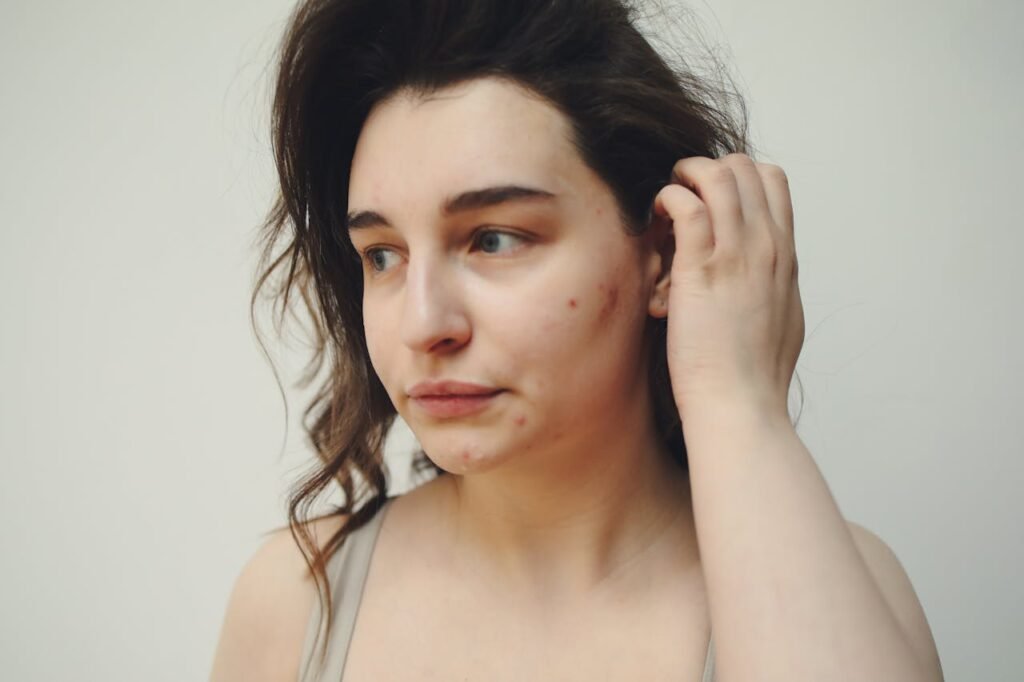 Chemical Peel in Miami