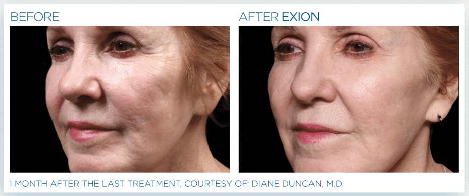 Collective Aesthetics treatment