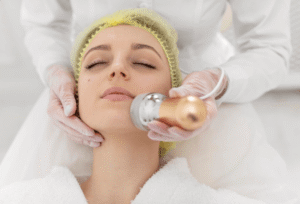 Fractional Radiofrequency Treatment in Florida