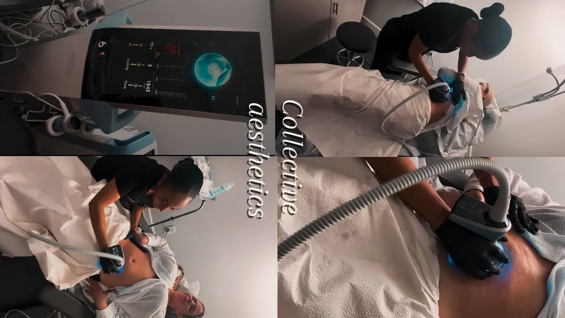 Exion, Emfemme, and Emtone Florida, Body Contouring Florida