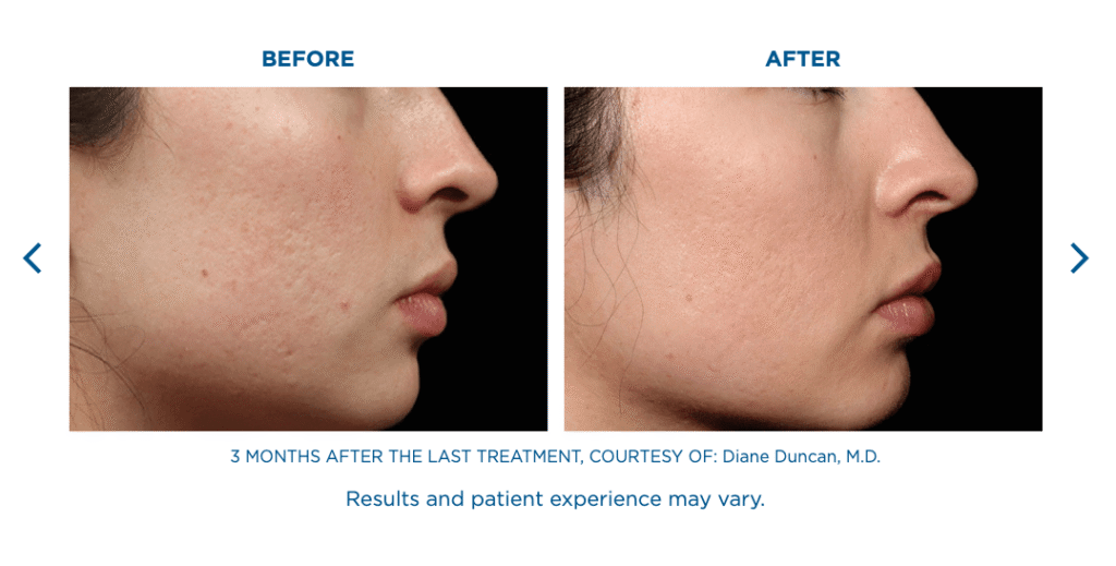 Skin Rejuvenation Miramar FL