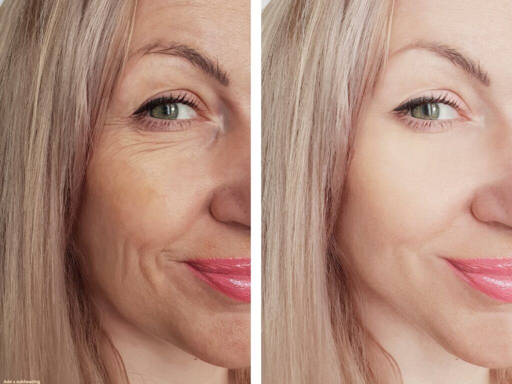 Can Hormones Affect Skin Aging?