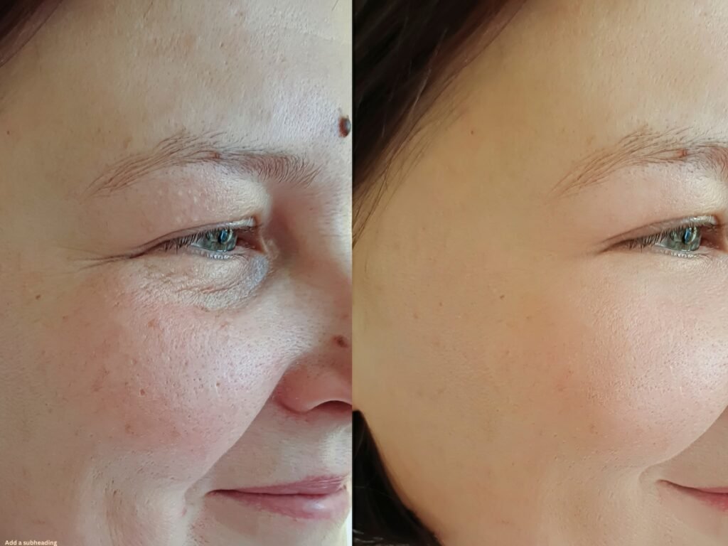 Can Hormones Affect Skin Aging?