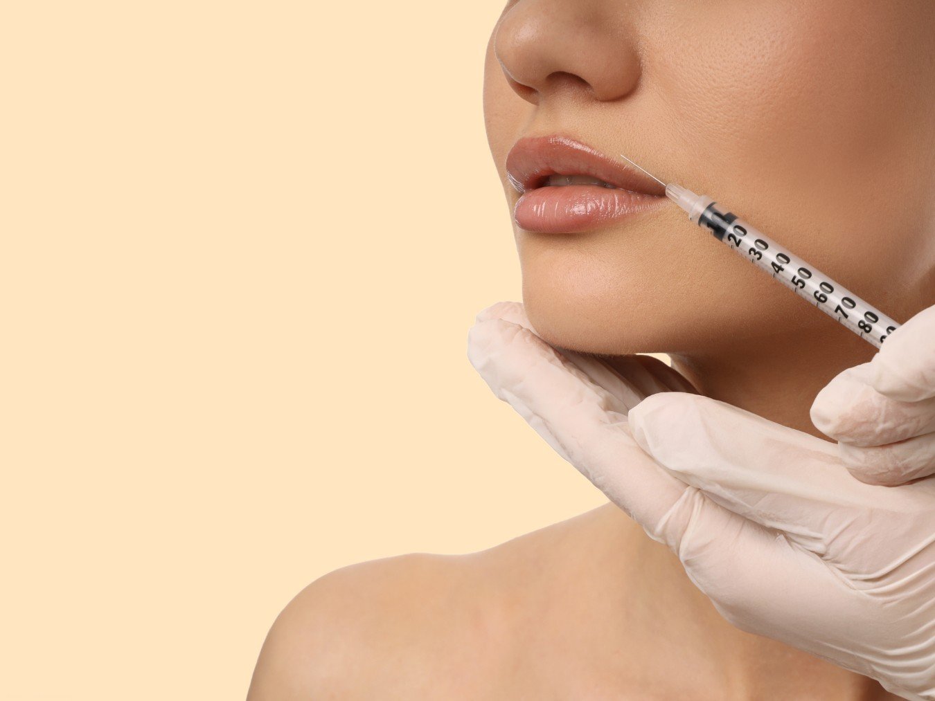 dermal filler, Best Lip Fillers in Miramar