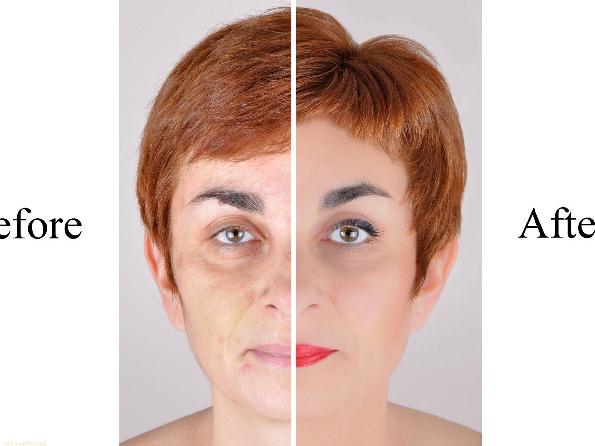 Skin Tightening Near Me