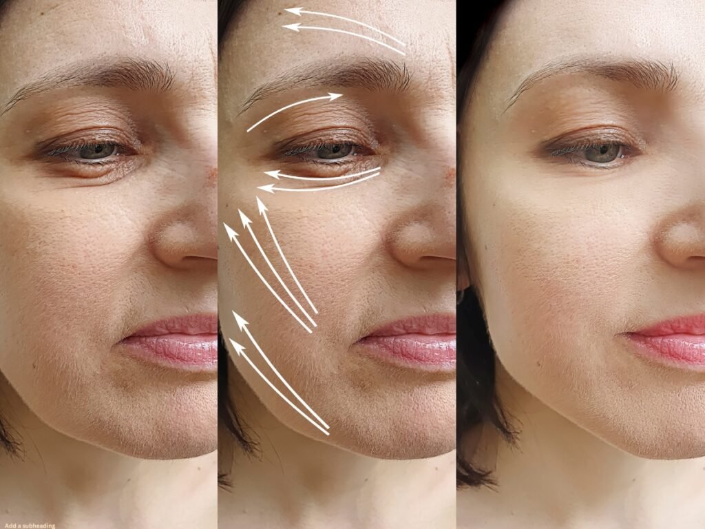 Cheek Fillers Near Me