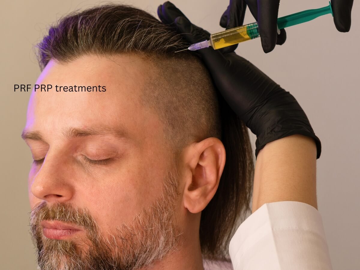 Hair Loss Treatment Near Me