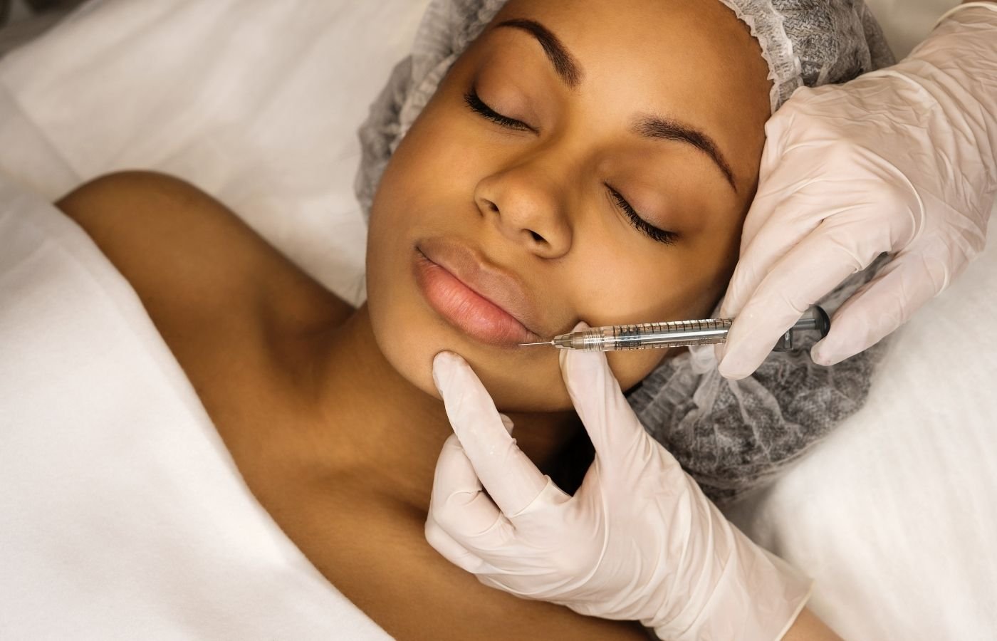 Lip Filler Miramar